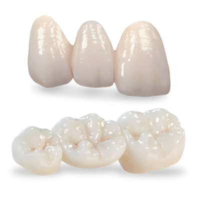 Bọc răng sứ