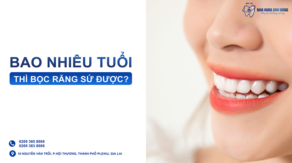 Bao nhiêu tuổi được bọc răng sứ?