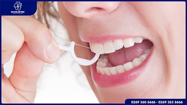 Một số lưu ý quan trọng trước khi bọc răng sứ
