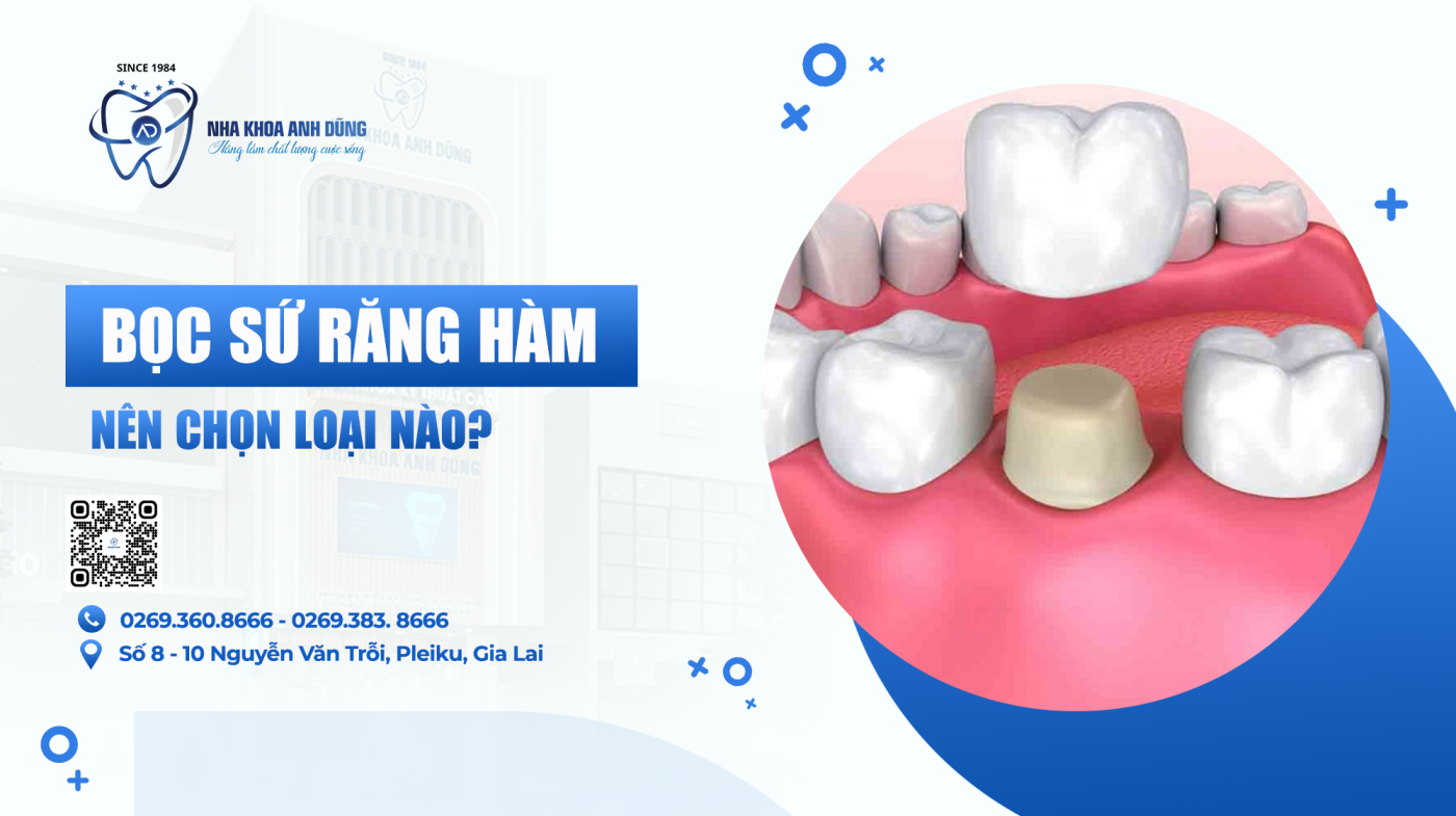 Bọc sứ răng hàm nên chọn loại nào?