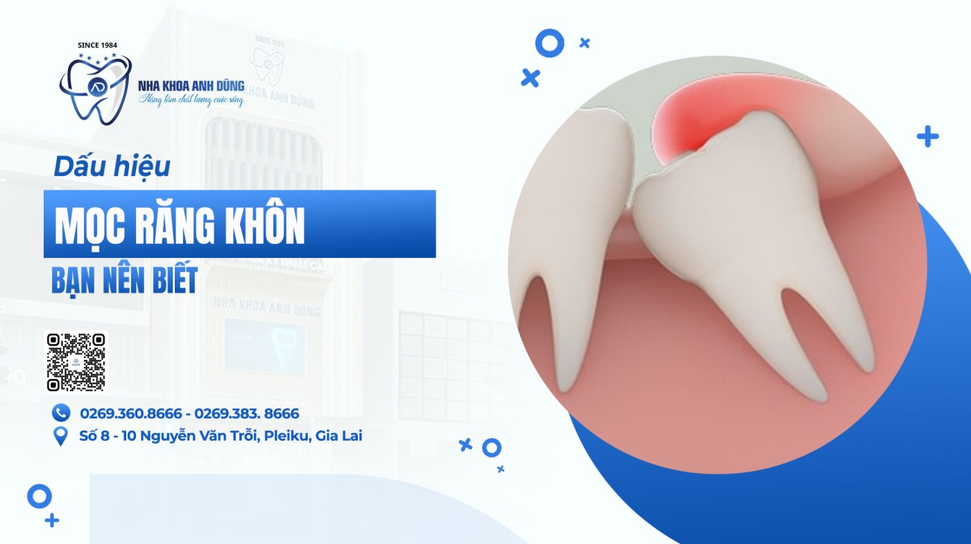 DẤU HIỆU MỌC RĂNG KHÔN BẠN NÊN BIẾT