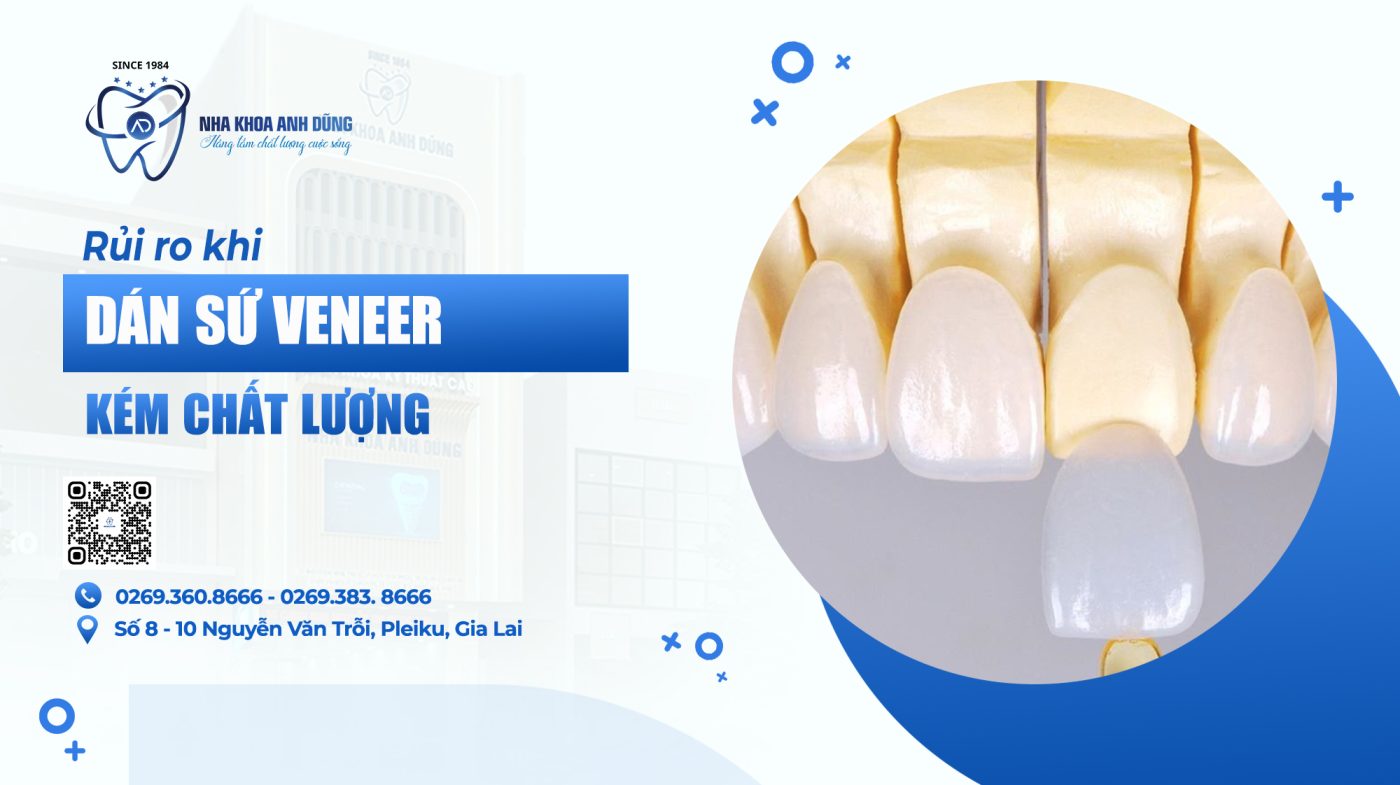 NHỮNG RỦI RO BẠN CÓ THỂ GẶP PHẢI KHI DÁN SỨ VENEER KÉM CHẤT LƯỢNG