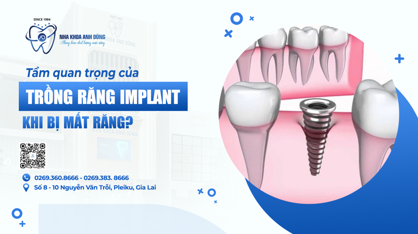 Tầm quan trọng của việc trồng răng Implant khi bị mất răng