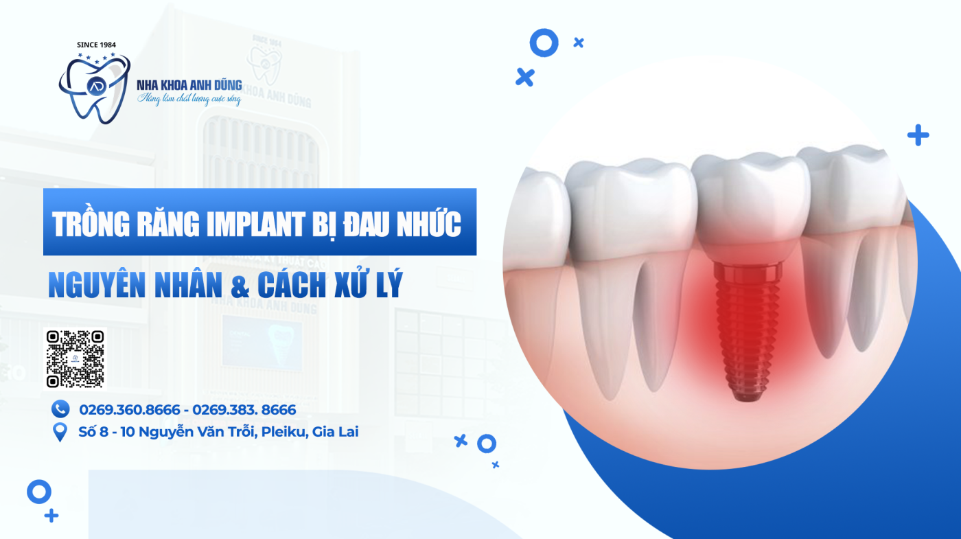 Trồng Ipmlant bị đau nhức, nguyên nhân và cách xử lý