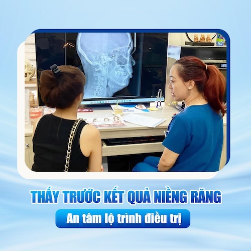 Công nghệ VTO trong niềng răng giúp khách hàng có thêm niềm tin và động lực hơn khi quyết định điều trị