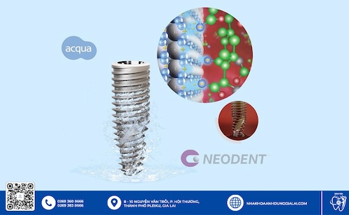 trụ implant neodent gia lai uy tín