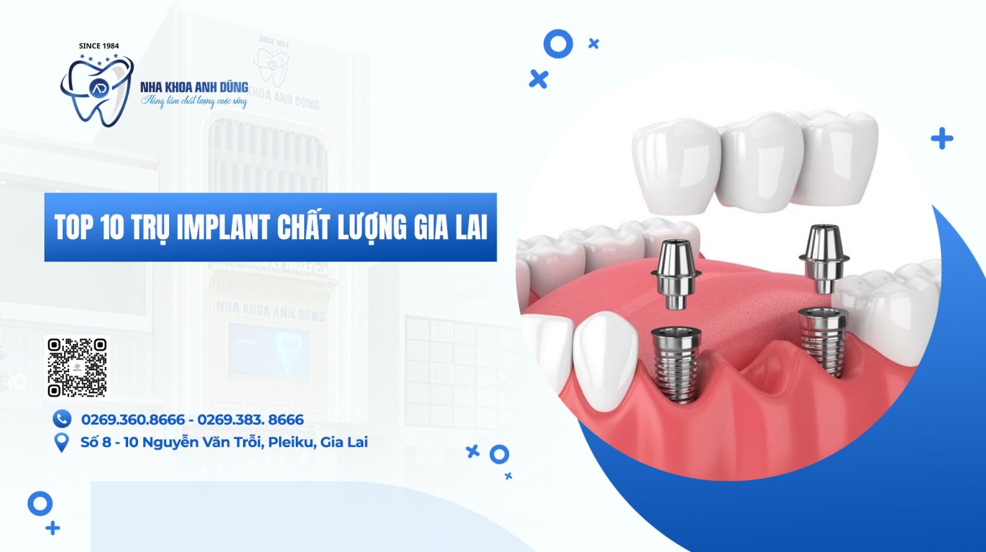 Top 10 trụ Implant chất lượng Gia Lai