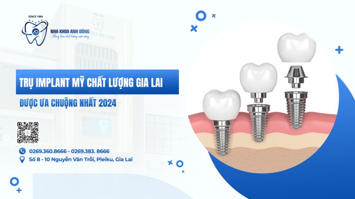 Trụ Implant Mỹ chất lượng Gia Lai được ưa chuộng nhất 2024