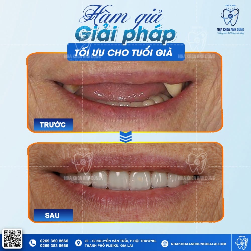 mat-rang-vinh-vien