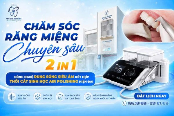 thoi-cat-sinh-hoc-air-polishing